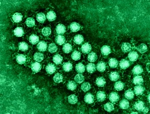 Чем опасен энтеровирус?
