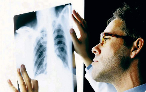 24 марта - Всемирный день борьбы с туберкулезом